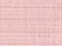 Capitolo 2 - ECG in TEP 1