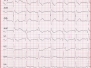 Capitolo 2 - ECG in TEP 2