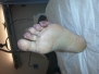 Capitolo 2 - Trash-foot