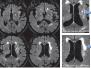 Capitolo 5 - RMN Ischemia Cerebrale 1