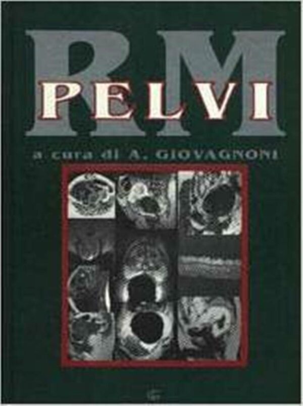 RM PELVI