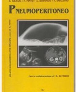 PNEUMOPERITONEO