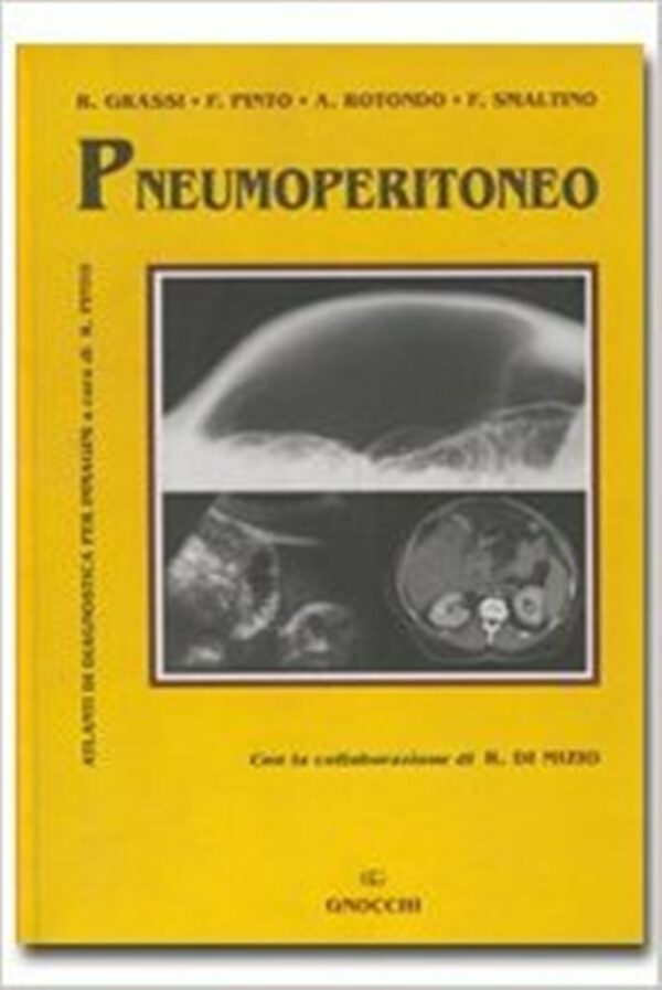 PNEUMOPERITONEO