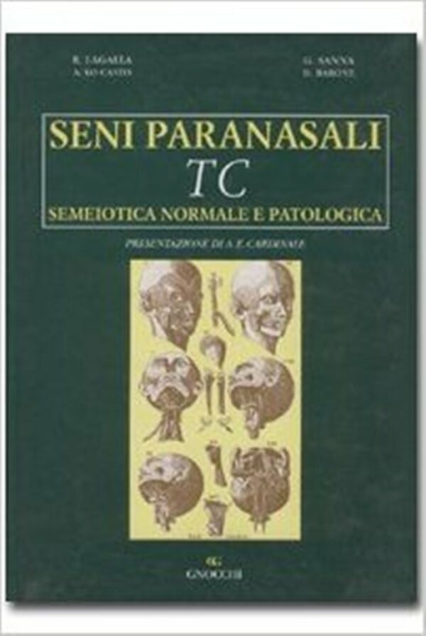 SENI PARANASALI TC. SEMEIOTICA NORMALE E PATOLOGICA
