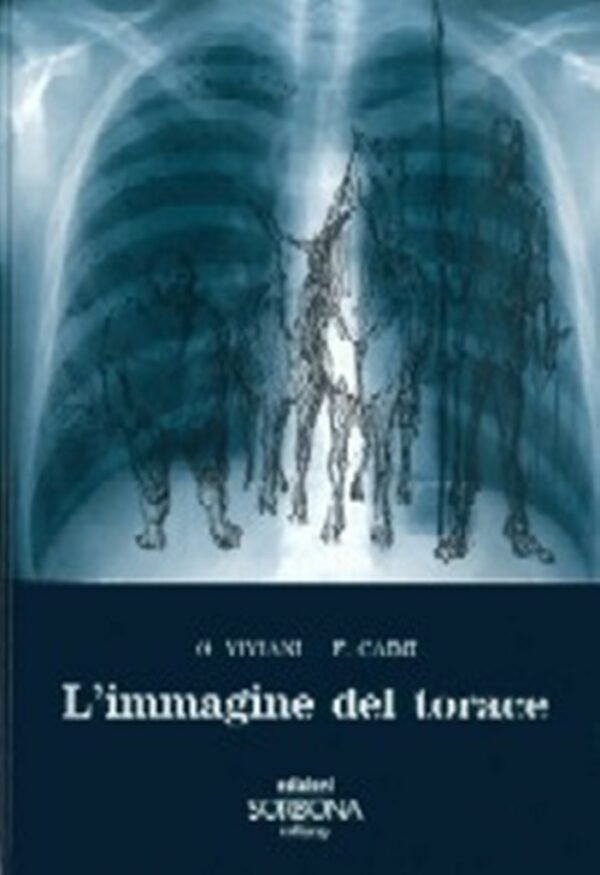 L'immagine del torace