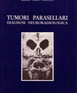 Tumori parasellari. Diagnosi neuroradiologica