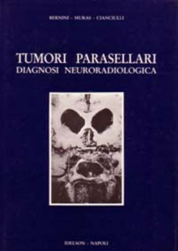 Tumori parasellari. Diagnosi neuroradiologica