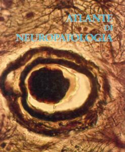 Atlante di neuropatologia