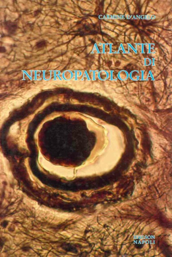 Atlante di neuropatologia
