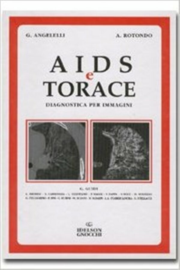 AIDS E TORACE - DIAGNOSTICA PER IMMAGINI