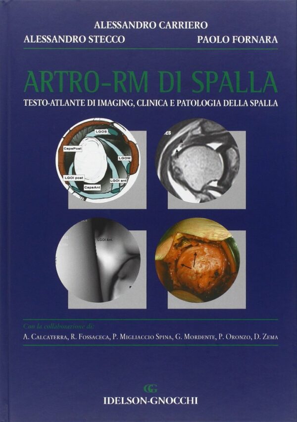 ARTRO-RM DI SPALLA