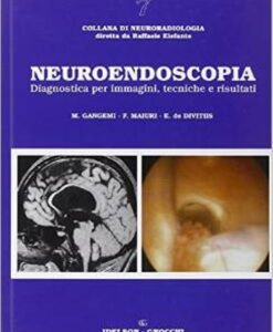 Neuroendoscopia