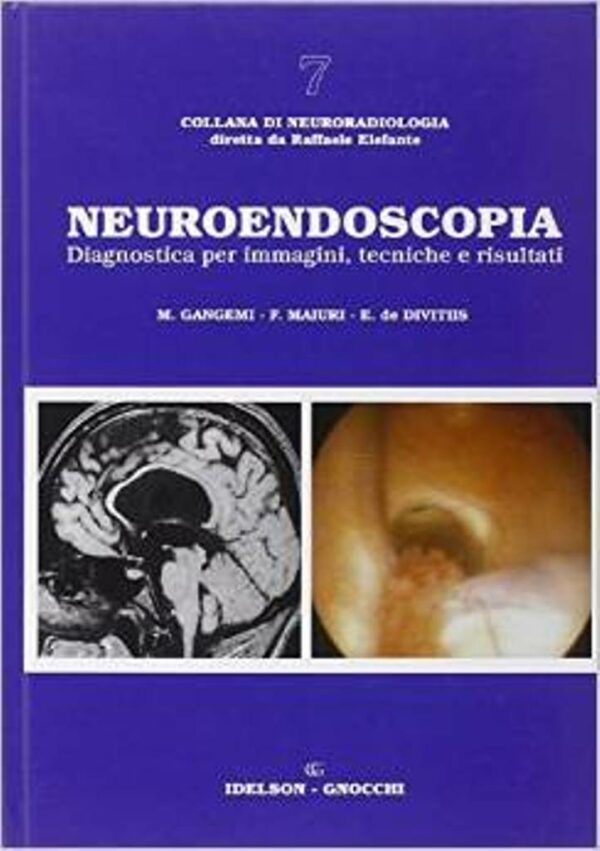 Neuroendoscopia