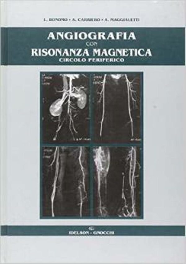 Angiografia con risonanza magnetica del circolo periferico