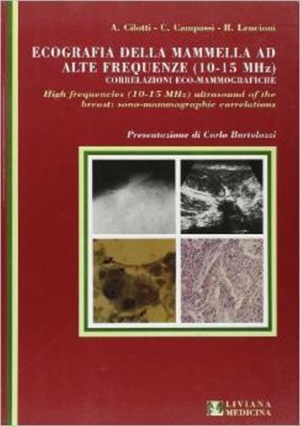 ECECOGRAFIA DELLA MAMMELLA AD ALTE FREQUENZE (10-15 MHZ)