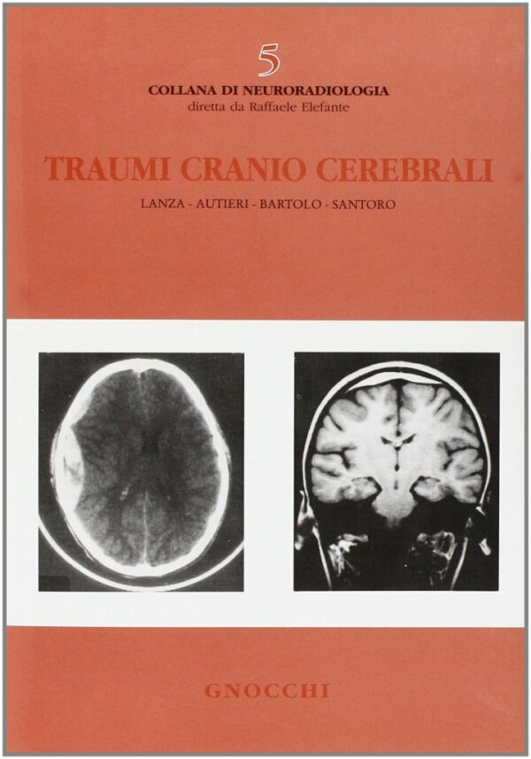 TRAUMI CRANIO CEREBRALI