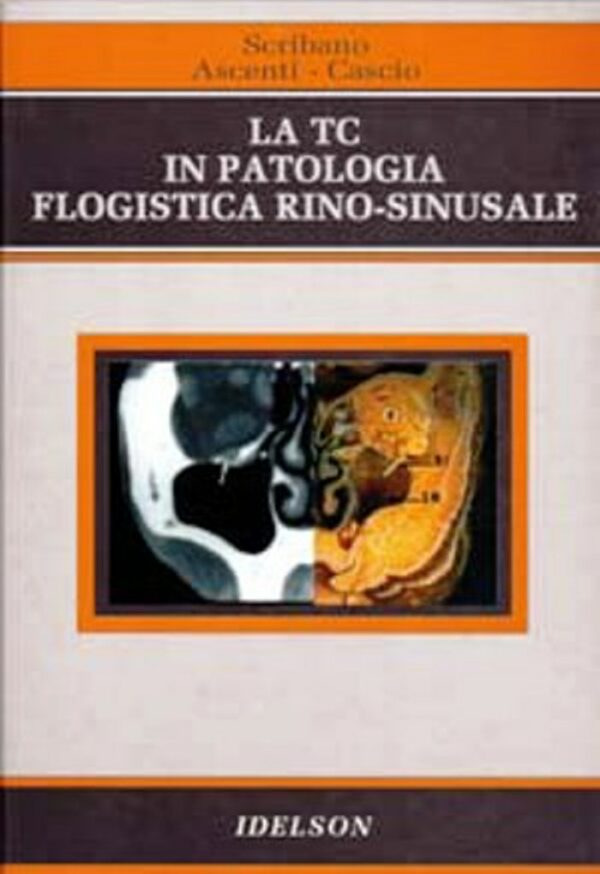 La TC in patologia flogistica rino-sinusale