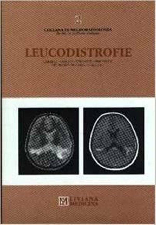 LEUCODISTROFIE