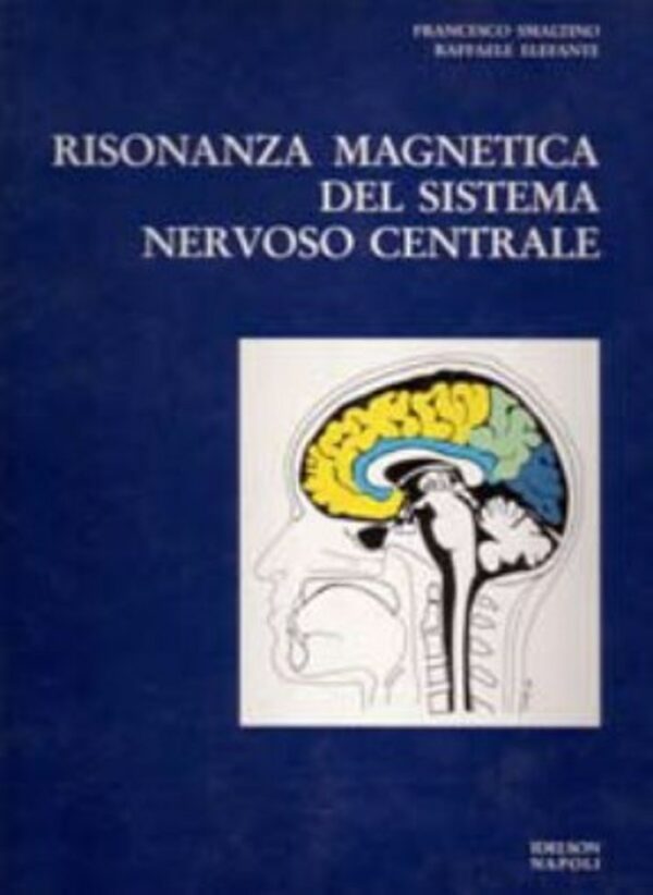 Risonanza magnetica del sistema nervoso