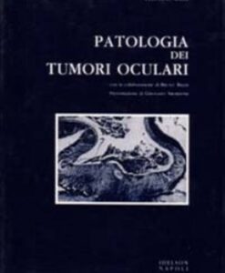 Patologia dei tumori oculari