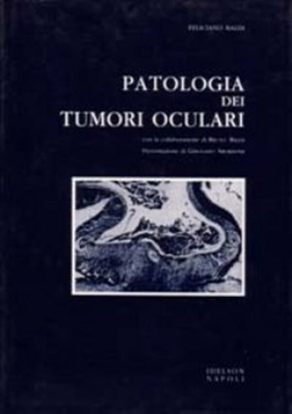 Patologia dei tumori oculari