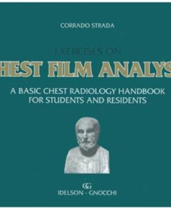 EXERCISES ON CHEST FILM ANALYSIS. A BASIC CHEST RADIOLOGY HANDBOOK FOR STUDENTS AND RESIDENTS