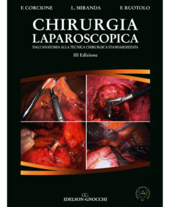 CHIRURGIA LAPAROSCOPICA